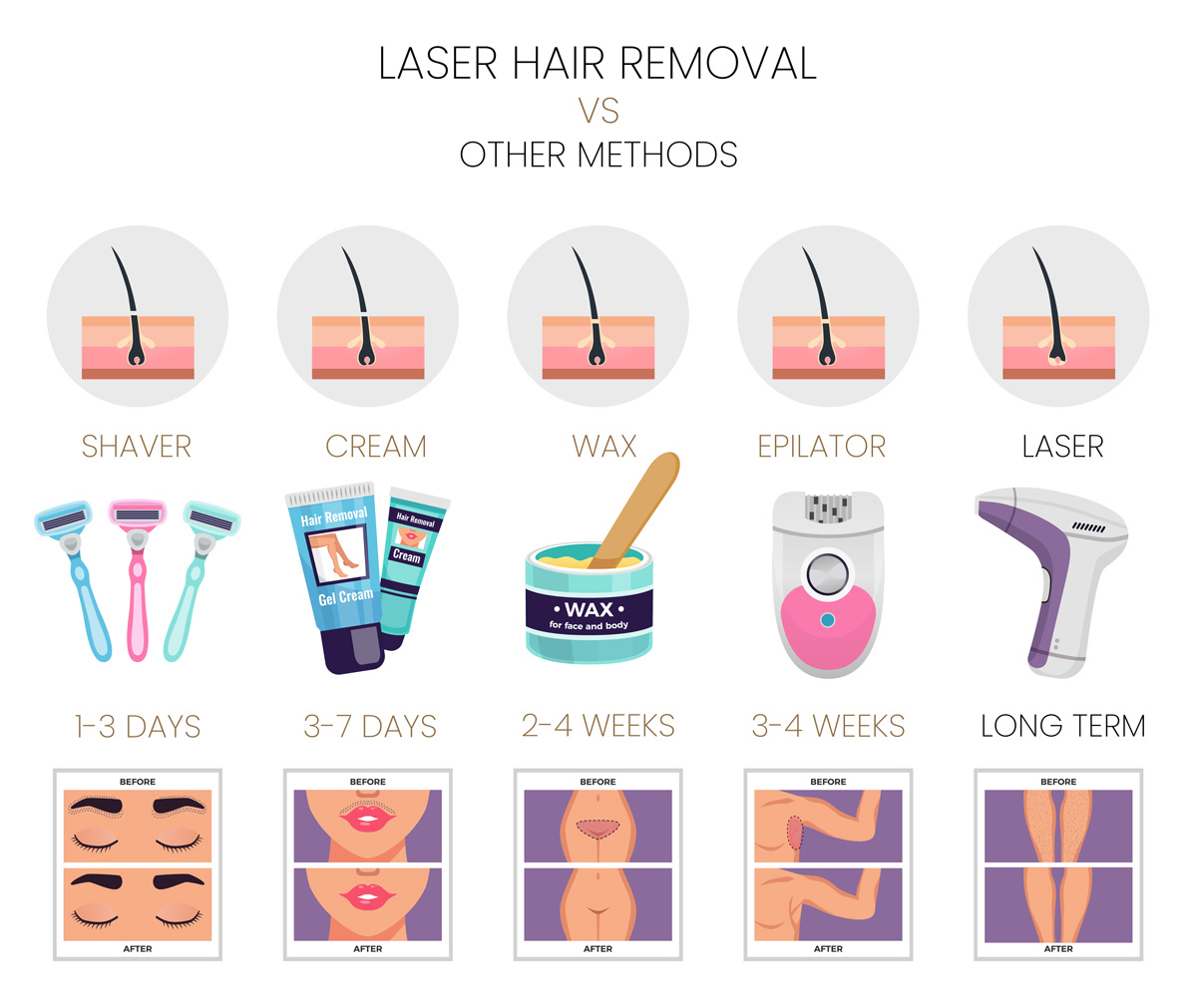 Laser Hair Removal vs other methods