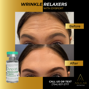 Wrinkle Relaxers at Aguilar Aesthetics Medspa