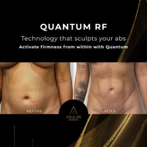 QuantumRF at Aguilar Aesthetics Medspa in Aventura, FL