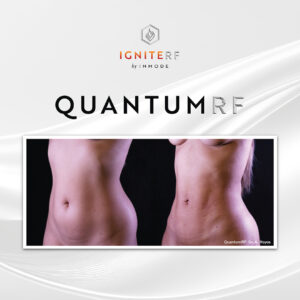 QuantumRF at Aguilar Aesthetics Medspa in Aventura, FL