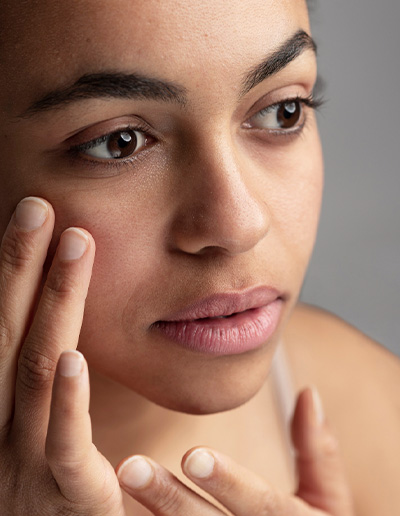 Dark Circles Under Eyes