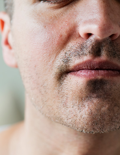 Large Pores