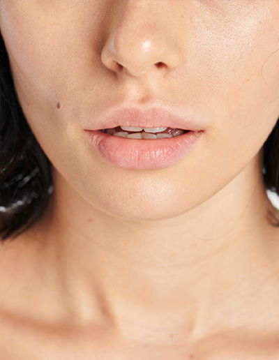 Thin Lips